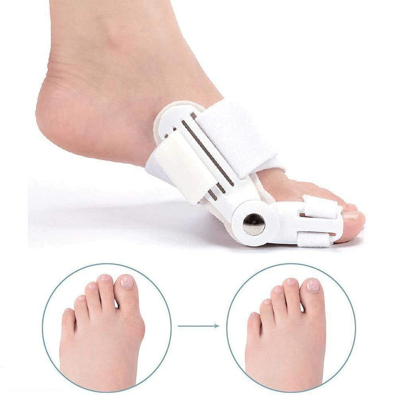 Korrigierende Schiene für Hallux Valgus