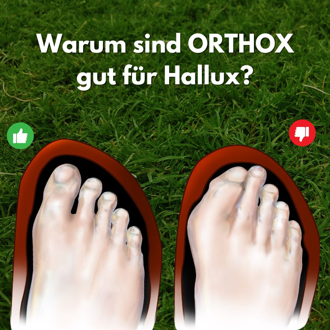 "Ergonomische Hallux Schuhe für Männer, atmungsaktiv mit breiter Zehenbox, ideal bei Hallux Valgus, schwarze Farbe."