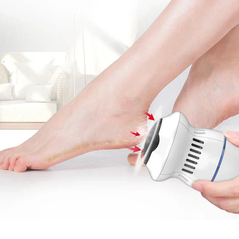 "Ergonomischer elektrischer Hornhautentferner, sanfte Fußpflege mit USB-Aufladung, effektives Design für weiche Füße"