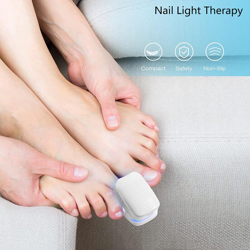 Kompaktes Lasergerät zur effektiven Nagelpilz-Reinigung, tragbar, benutzerfreundlich, für gesunde, schönere Nägel.