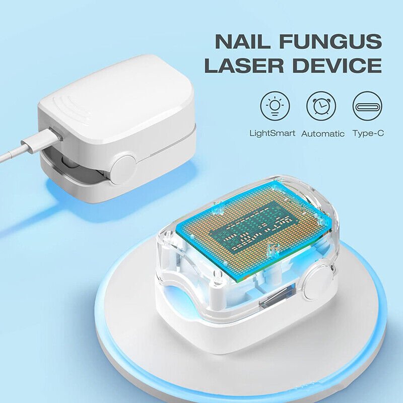 Kompaktes Lasergerät zur effektiven Nagelpilz-Reinigung, tragbar, benutzerfreundlich, für gesunde, schönere Nägel.