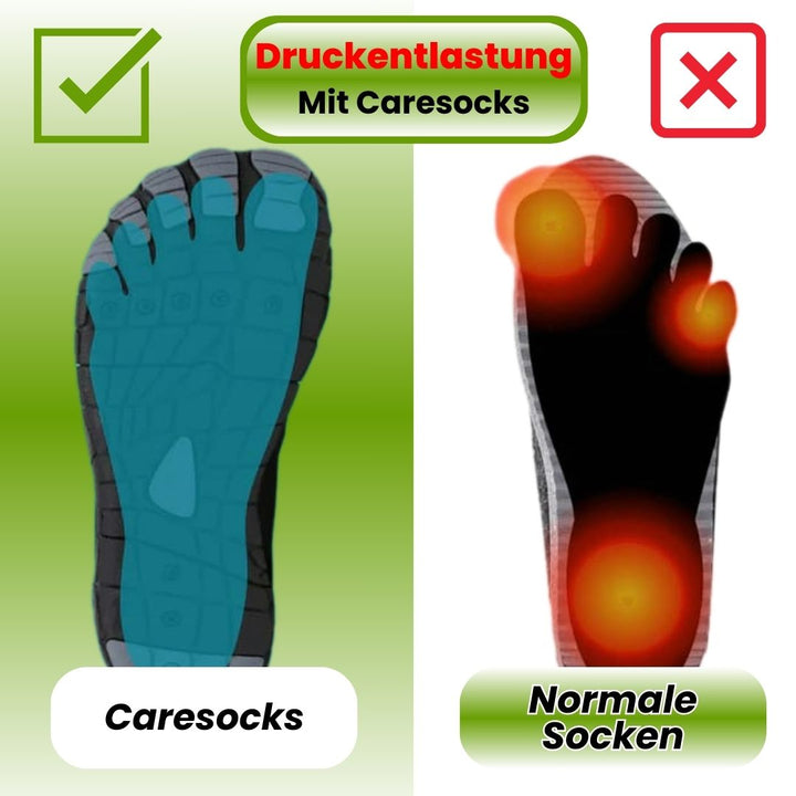 Kompressionsstrümpfe für Damen in Hautfarbe, elastisch mit gezielter Kompression zur Linderung von Fersen- und Fußschmerzen.