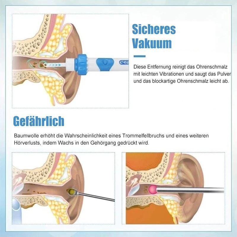 "Ohrenschmalzentferner Staubsauger mit sanfter Vibration, kompakt und sicher aus BPA-freiem Kunststoff, für alle Ohren."