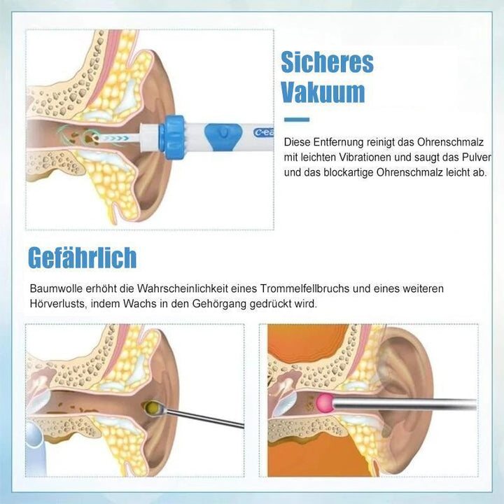 "Ohrenschmalzentferner Staubsauger mit sanfter Vibration, kompakt und sicher aus BPA-freiem Kunststoff, für alle Ohren."