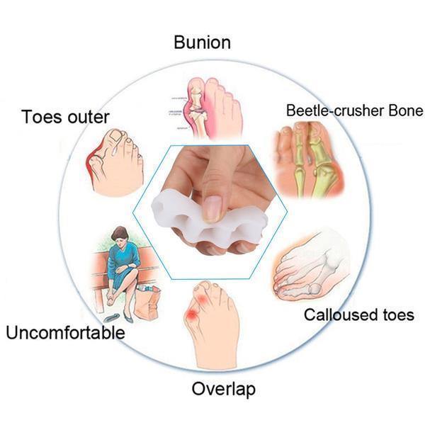 "Orthopädischer Zehenkorrektor: Hautfarben, flexibles Design, für Komfort und Entlastung bei Hallux Valgus und Hammerzehen."
