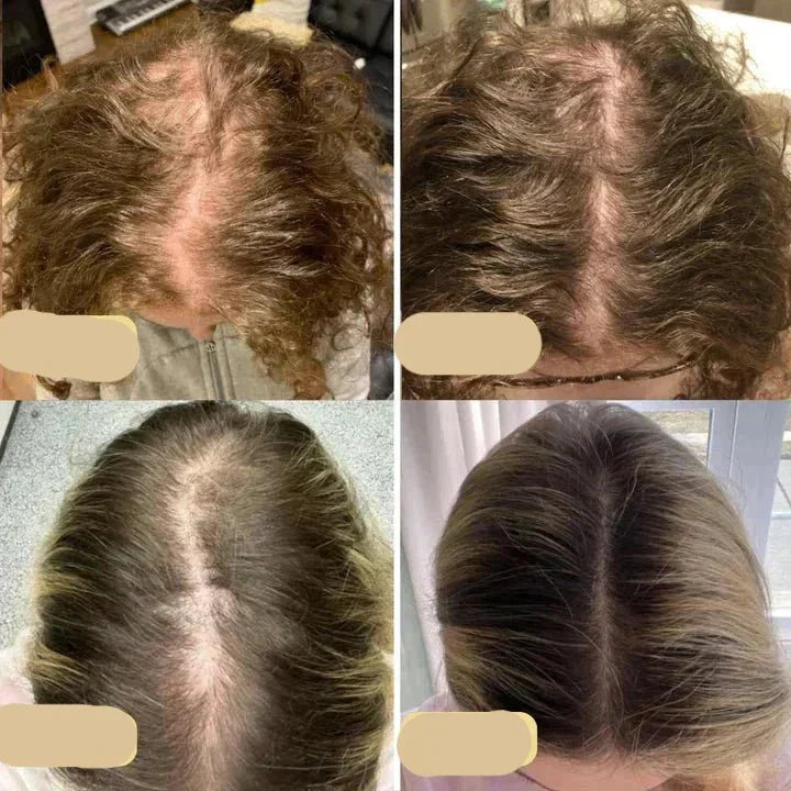 "Veganes Haarwuchsöl in Glasflasche, reich an Arganöl und Rosmarin, fördert gesundes Haarwachstum und schützt vor Haarbruch."