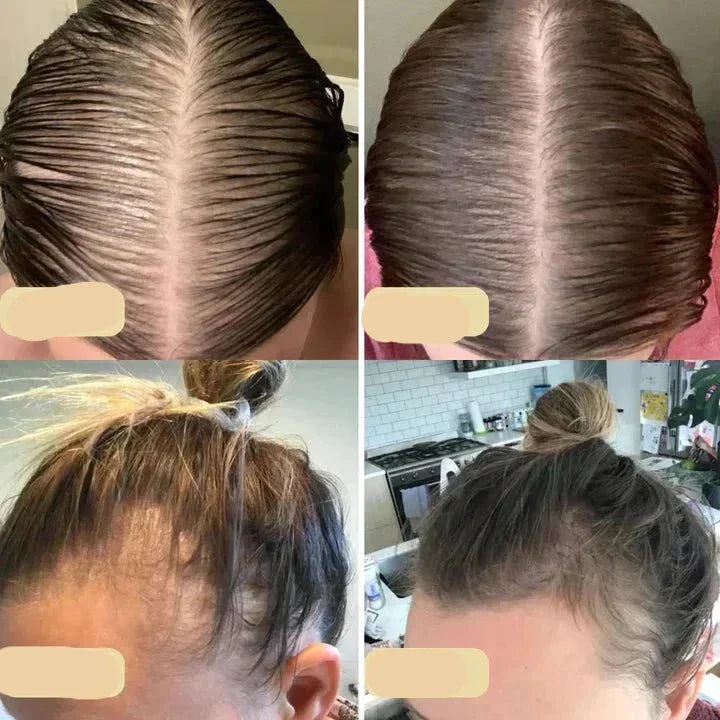 "Veganes Haarwuchsöl in Glasflasche, reich an Arganöl und Rosmarin, fördert gesundes Haarwachstum und schützt vor Haarbruch."