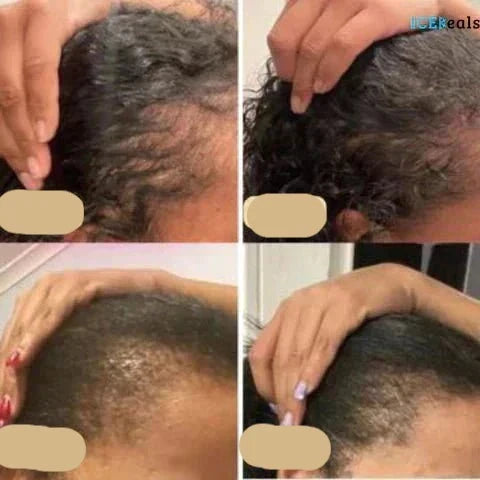 "Veganes Haarwuchsöl in Glasflasche, reich an Arganöl und Rosmarin, fördert gesundes Haarwachstum und schützt vor Haarbruch."